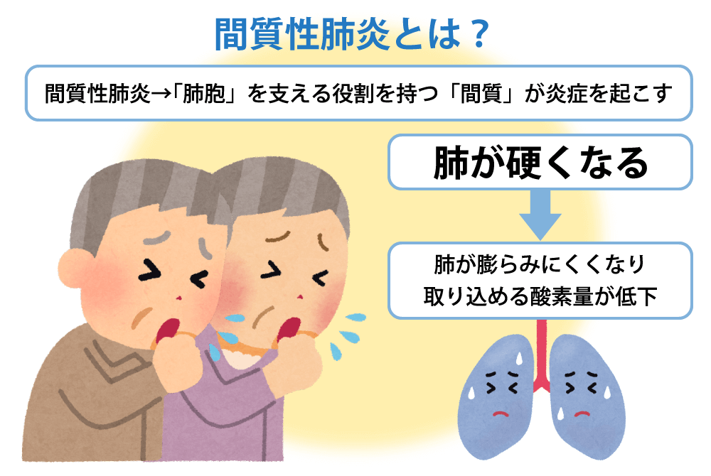 間質性肺炎とは？間質性肺炎→「肺胞」を支える役割を持つ「間質」が炎症を起こす 肺が硬くなる→肺が膨らみにくくなり取り込める酸素量が低下